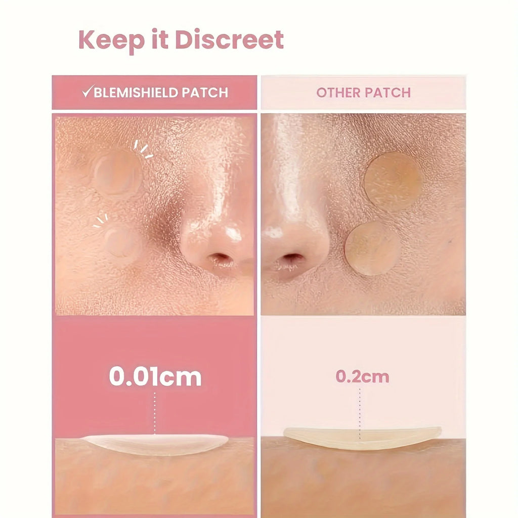 36pcs Skin-Calming Acne Patches - Hydrocolloid Technology Gently Heals Blemishes, invisibleProtection.